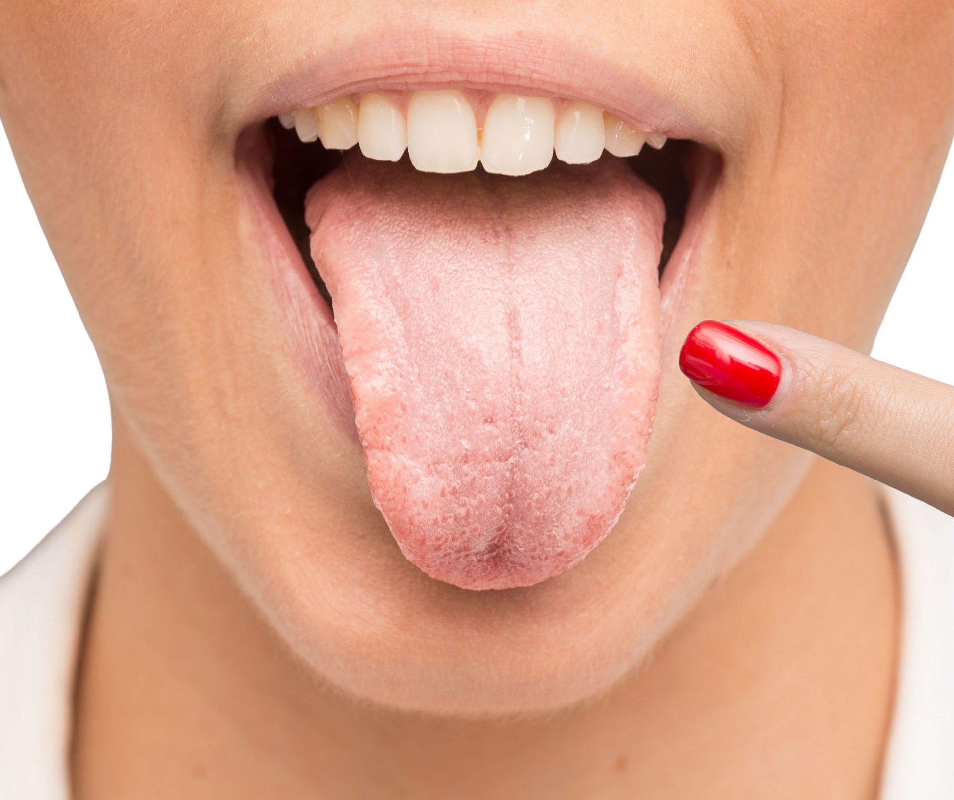 Candida Overgrowth: A Functional Medicine Approach to Healing
