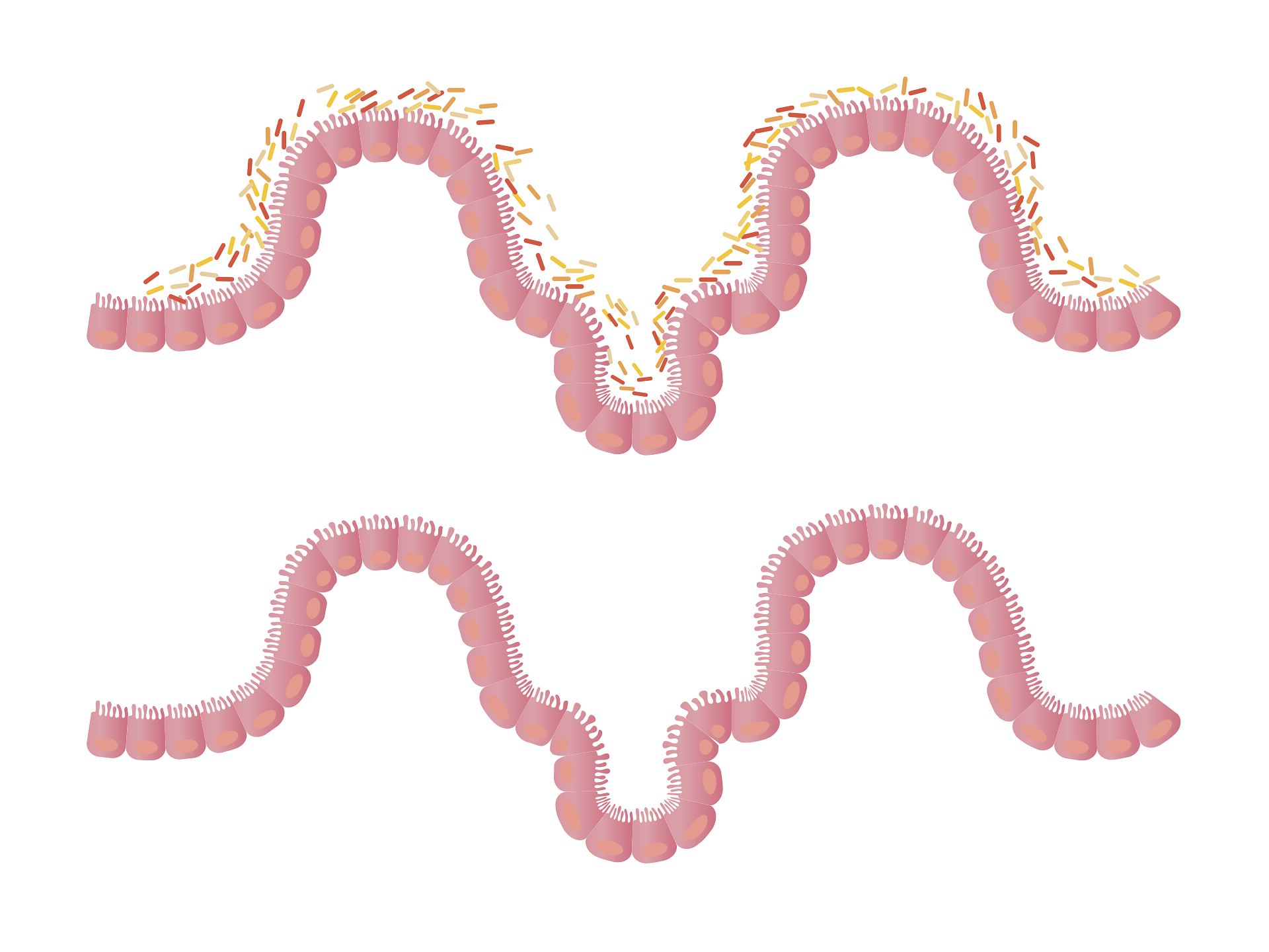 Leaky gut: What is it and how to heal It naturally